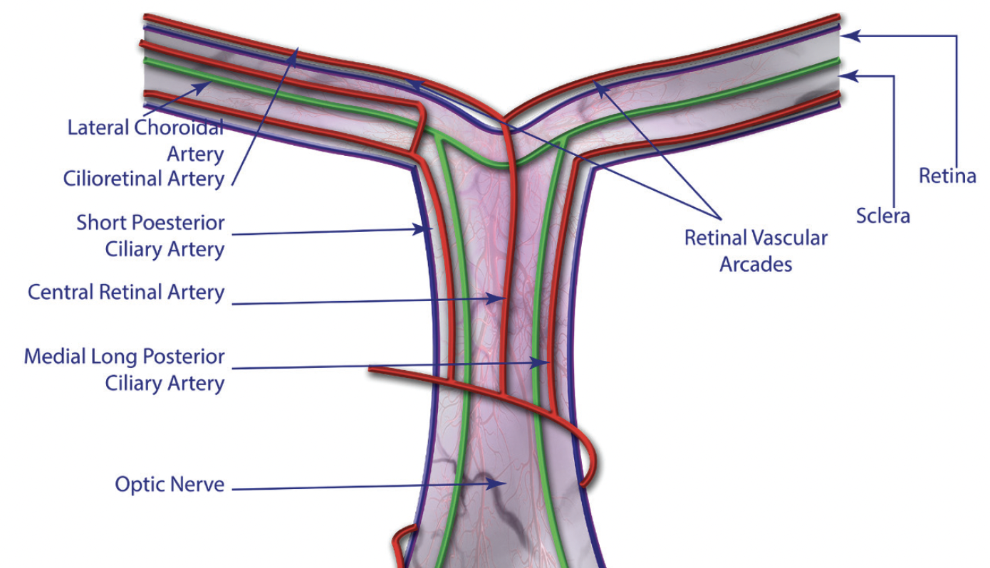 The Mystery of Cilioretinal Arteries and AMD - Modern Optometry