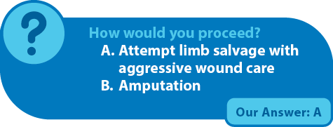 Multidisciplinary Limb Salvage in a CLI Patient With Complex Care ...