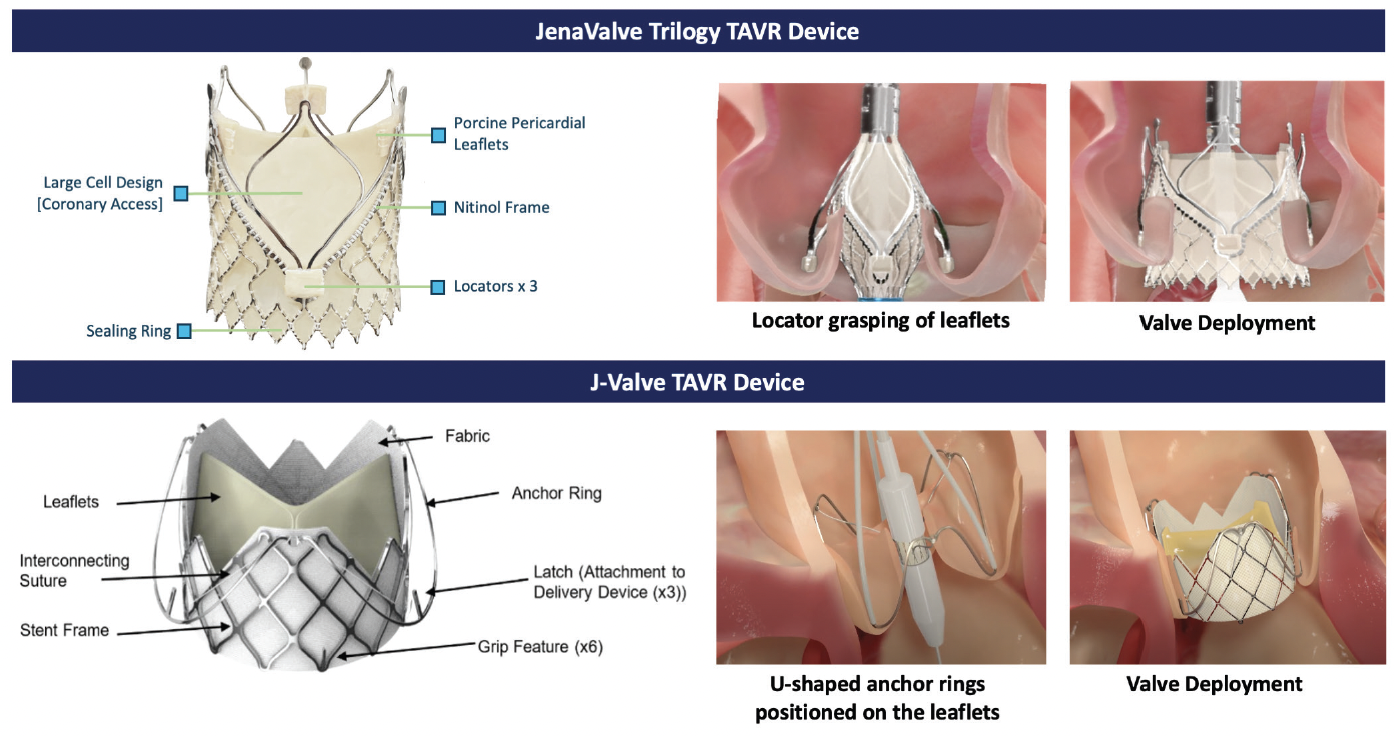 Current and Future TAVR Devices for Aortic Insufficiency - Cardiac ...