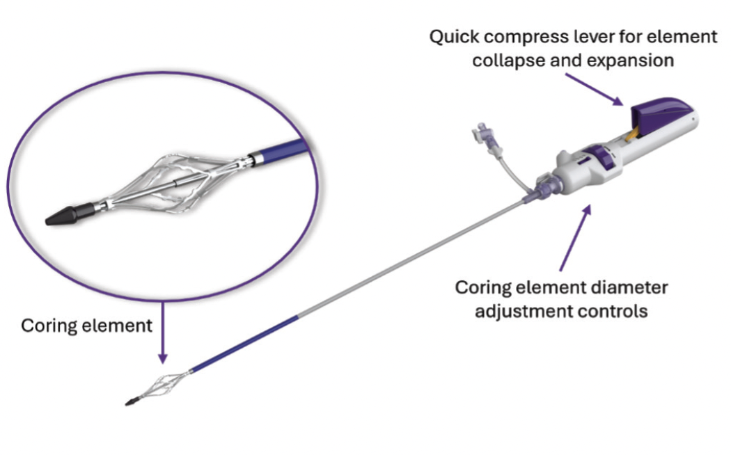 Breaking New Ground to Address Challenging Venous Occlusions ...