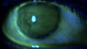 Fluorescein: An ode to a humble stain