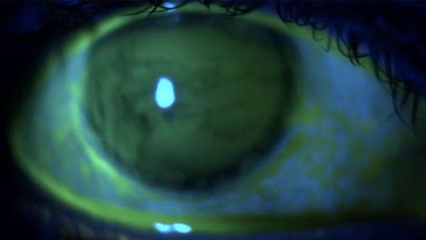 Fluorescein: An ode to a humble stain thumbnail