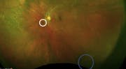 A Path Forward: Comanaging Patients With SVO