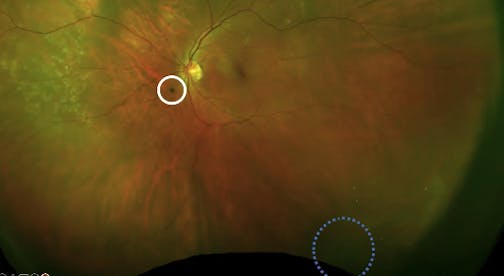 A Path Forward: Comanaging Patients With SVO