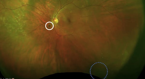 A Path Forward: Comanaging Patients With SVO thumbnail
