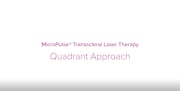 Application of MicroPulse TLT utilizing the MicroPulse P3 Probe