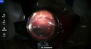 Peeling Under Oil
