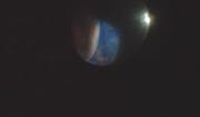 Suprachoroidal Infusion