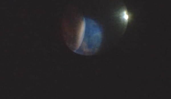 Suprachoroidal Infusion thumbnail