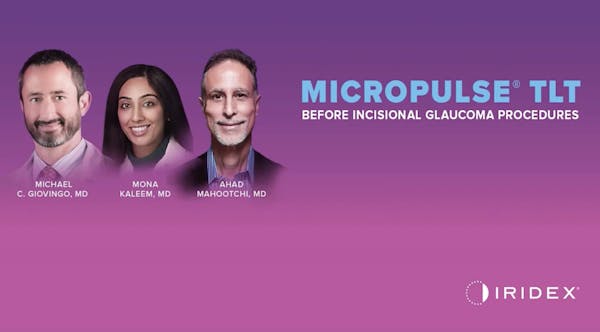 MicroPulse Transscleral Laser Therapy in Combination With Other Glaucoma Treatments thumbnail