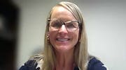 Practice Pearls: Glaucoma Drugs and Integrative Therapeutic Options