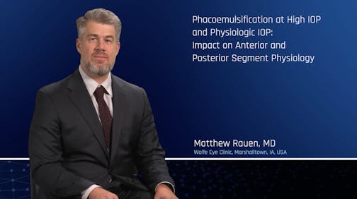 Phacoemulsification at a Lower and Higher IOP; Impact on Anterior and Posterior Segment Physiology