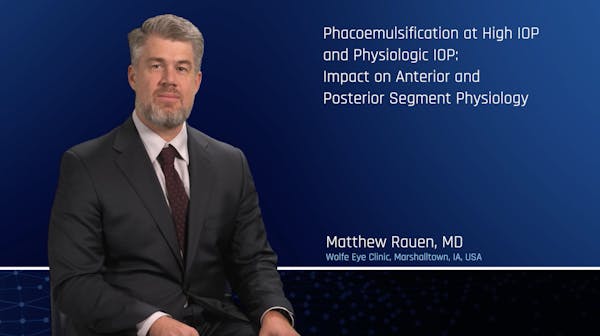 Phacoemulsification at a Lower and Higher IOP; Impact on Anterior and Posterior Segment Physiology thumbnail