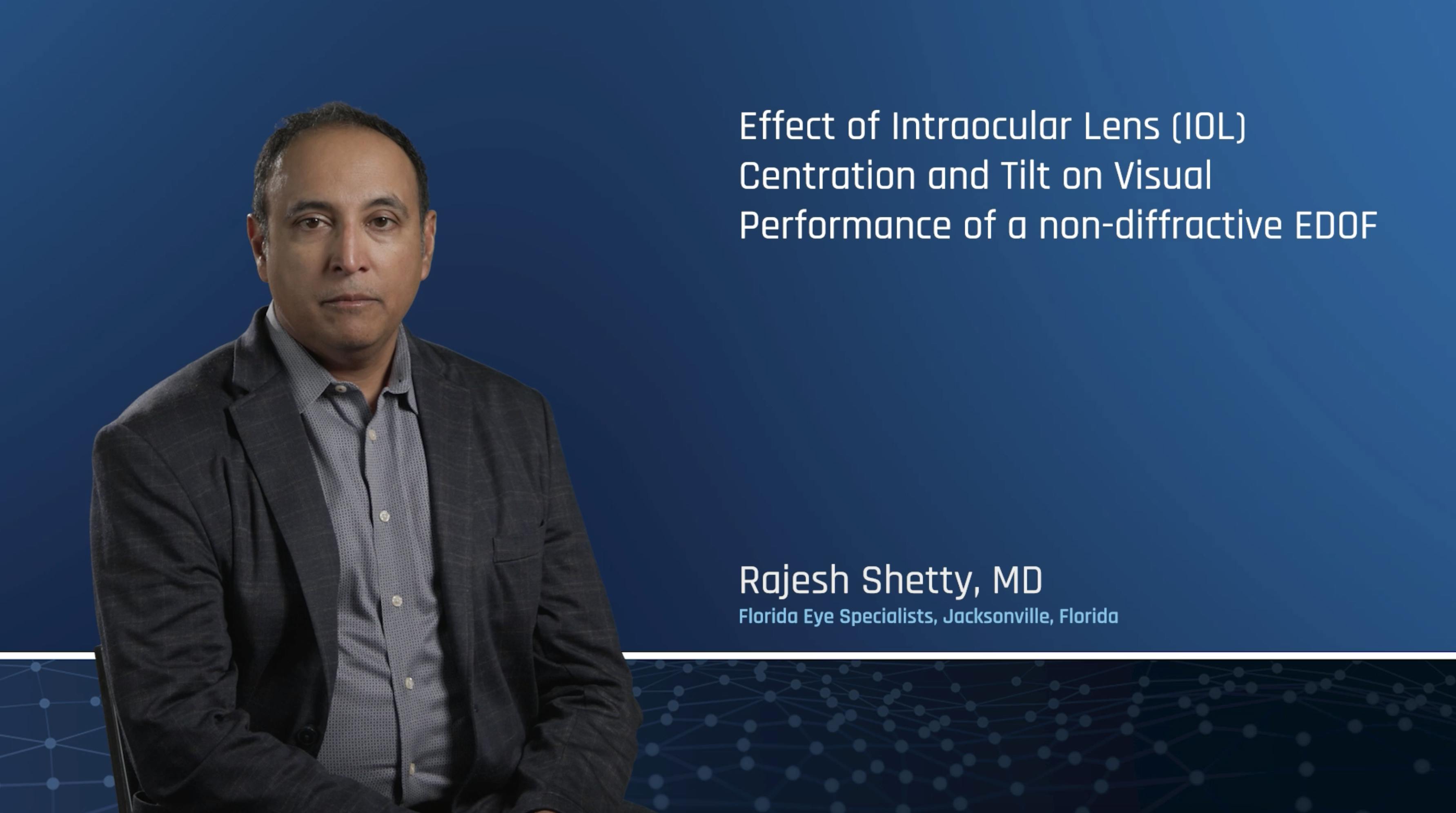 An Ambispective Study To Evaluate The Effect Of Intraocular Lens (IOL) Centration And Tilt On Visual Performance In Patients Who Have Undergone Vivity IOL Implantation.
