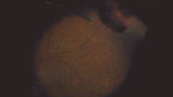 Small Orbit thumbnail