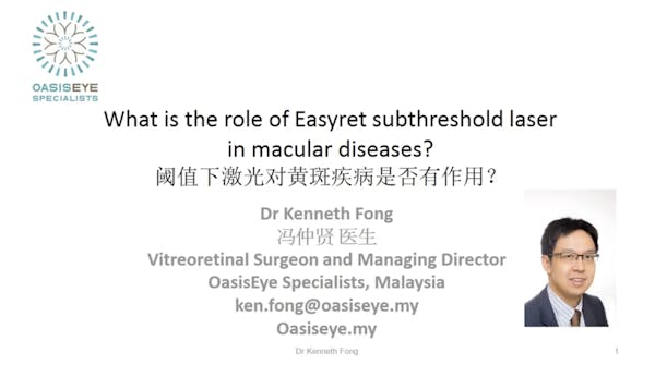 What Is the Role of the Easyret Subthreshold Laser in Macular Diseases? thumbnail