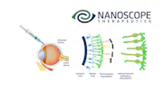 FDA Accepts Nanoscope’s BLA for Optogenetic Gene Therapy Mogenry for RP thumbnail