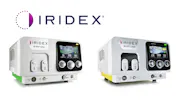 Iridex Launches Two Laser Platforms in US for Glaucoma and Retinal Diseases thumbnail