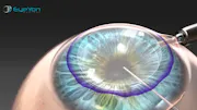 story 3 thumbnail