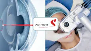 Ziemer Cataract and Refractive Surgery Innovations thumbnail