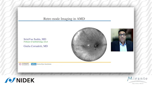 Retro mode imaging in AMD