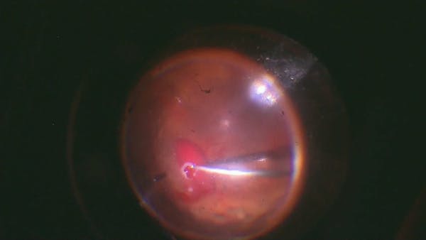 Vitreous Shaving thumbnail