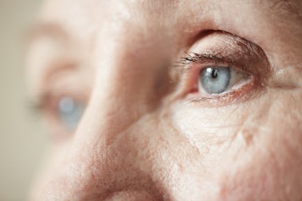 Managing Eye-Related Adverse Events Caused by Cancer Treatments thumbnail