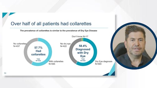 The Real-World Prevalence of Collarettes and <i>Demodex</i> Blepharitis in Eye Care Practices