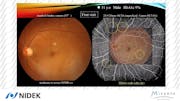 Expert Experience with Multimodal Imaging - A Deep Dive Into Wider Retinal Imaging