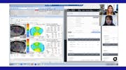Digital Cataract Surgery Planning: Insights from a Surgical Coordinator