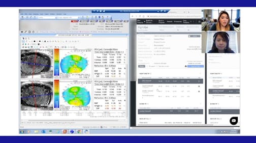 Digital Cataract Surgery Planning: Insights from a Surgical Coordinator
