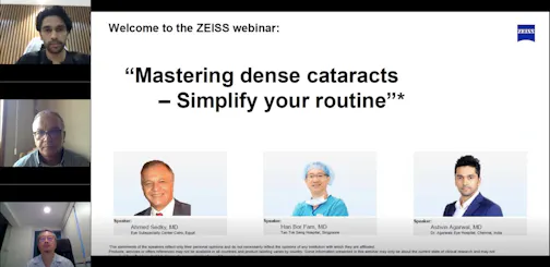 Mastering Dense Cataracts: Simplify Your Routine