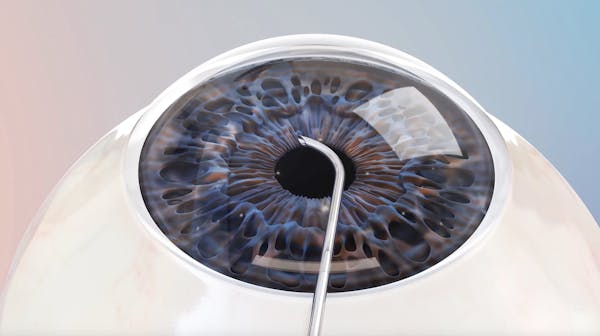 The OMNI® Surgical System thumbnail