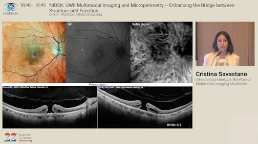 UWF Multimodal Imaging and Microperimetry - Enhancing the Bridge Between Structure and Function