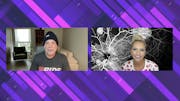 Treatment Options for Geographic Atrophy