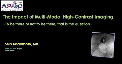 The Impact of Multi-Modal High-Contrast Imaging: To Be There or Not to Be There, That is the Question