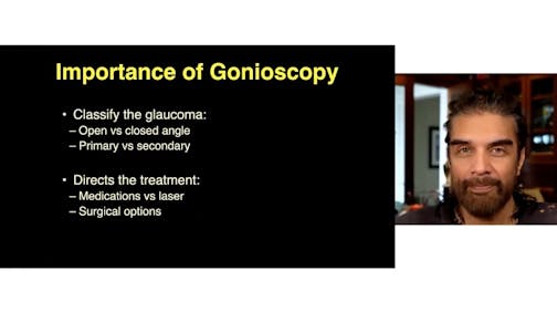 NIDEK Gonioscope Imaging