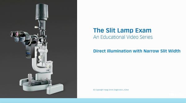 Direct Illumination thumbnail