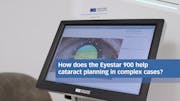 Planning Complex Cataract Cases With the Eyestar 900