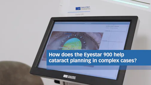 Planning Complex Cataract Cases With the Eyestar 900