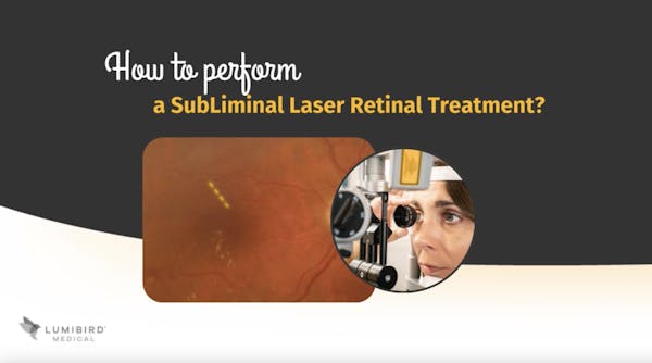 How to Perform a SubLiminal Laser Retinal Treatment? thumbnail