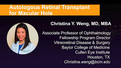 Autologous Retinal Transplant for Macular Hole