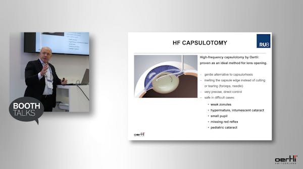 Booth Talk: HF Capsulotomy - Perfect Control in High Intracapsular Pressure thumbnail