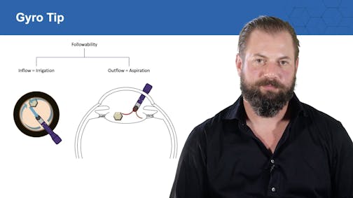 Cutting-Edge Approach to Cataract Surgery