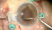 Carlevale Lens