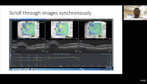 Maximizing Retinal Imaging