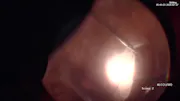 PVR