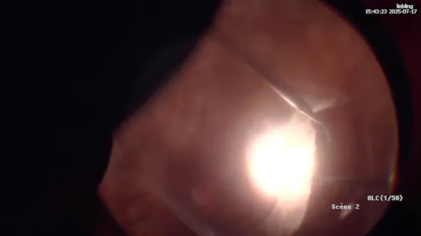 PVR thumbnail