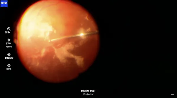 Nanophthalmos thumbnail