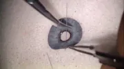 Anterior Chamber Reconstruction